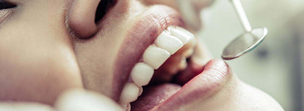 HM Dent Dental Implant Clinic - Estetica si Protetica Dentara