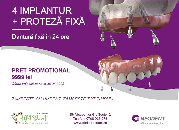 proteza dentara fixa pret promotional
